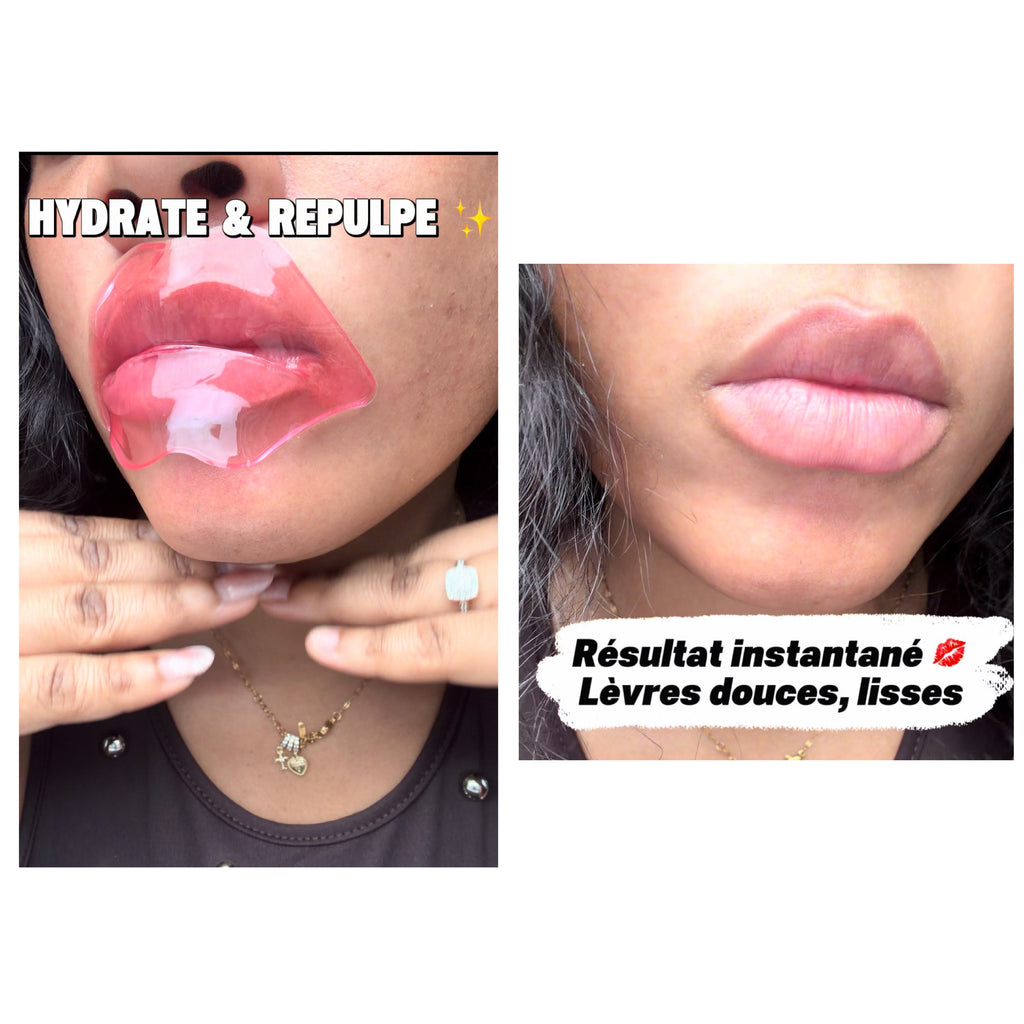 PATCH GEL MASQUE Qui HYDRATE et Repulpe les lèvres